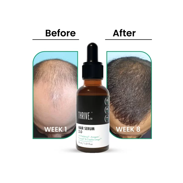 ThriveCo Hair Growth Serum 2.0 with Redensyl 30ml - Cureka